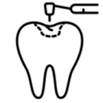 Endodoncia